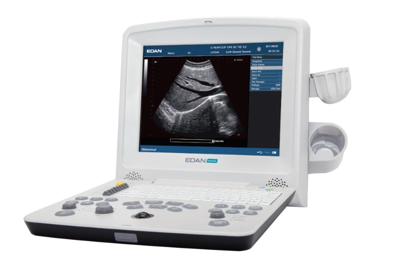 Portable ultrasound scanner